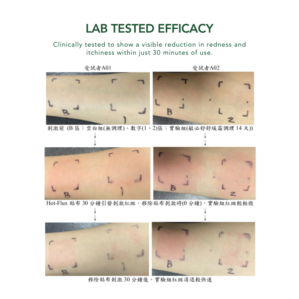 Ming Sing Itch Reliever Roll-On (10mL)